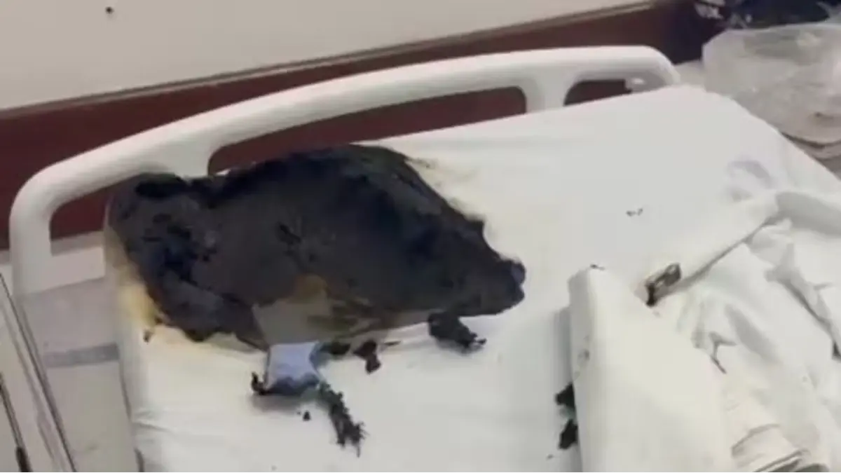 Internado com spray e isqueiro: paciente ateia fogo em colega de quarto no Lourenço Jorge
